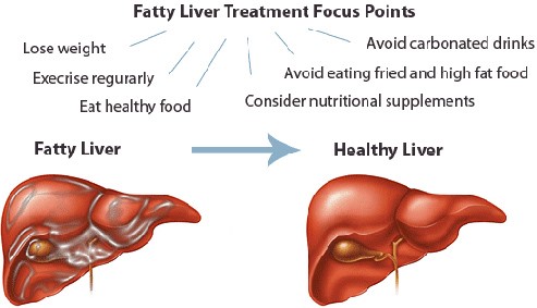 Ayurvedic Liver Health